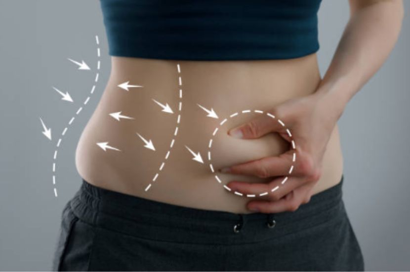 Types of Belly Fat. Will Treadmill Reduce Belly Fat?